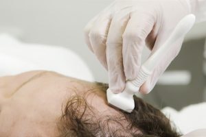 biggest bridal concerns