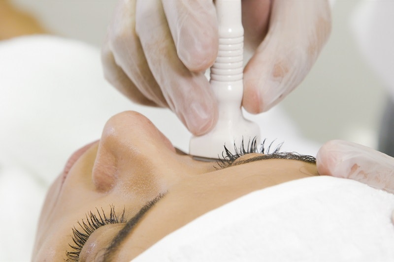 Dermastamp treatment