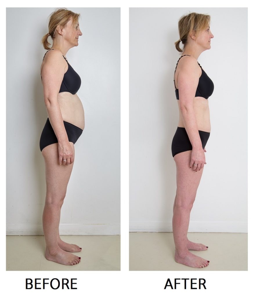 Pauline Before & After