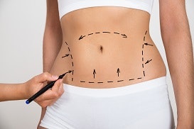 Vaser Liposuction
