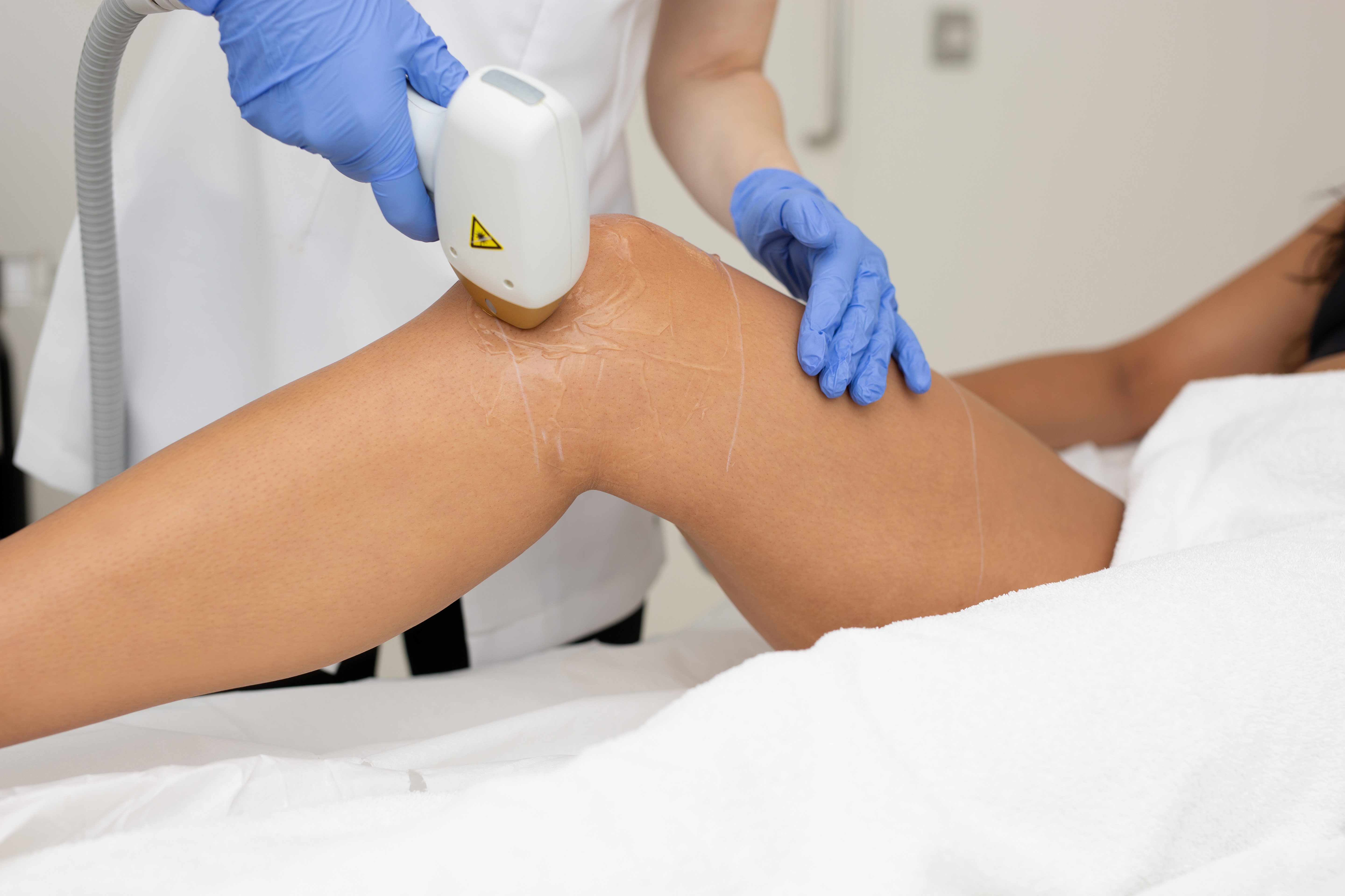 What areas can be treated with Laser Hair Removal in London? EF MEDISPA