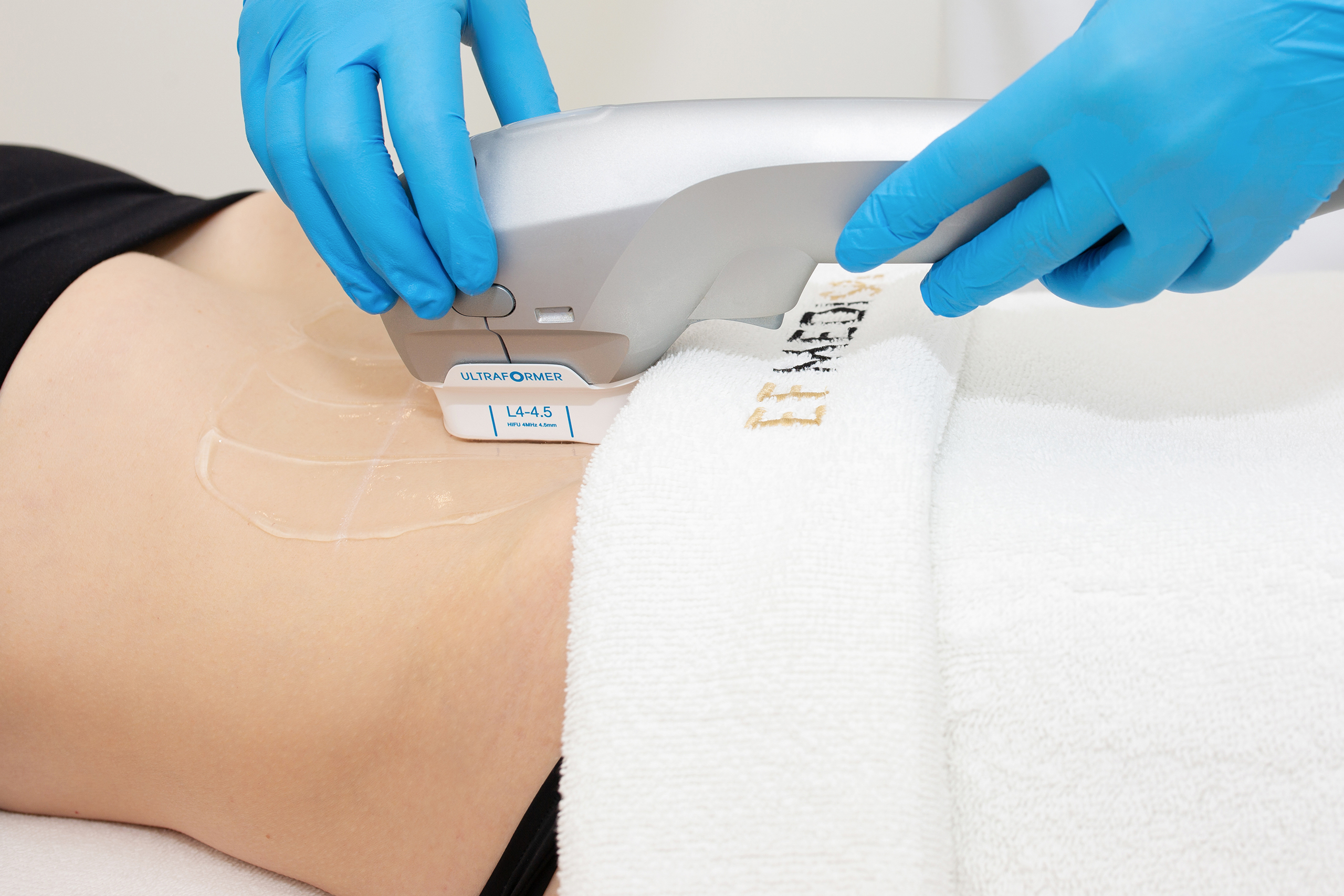 Why should have 3D Skinlift London at EF MEDISPA?
