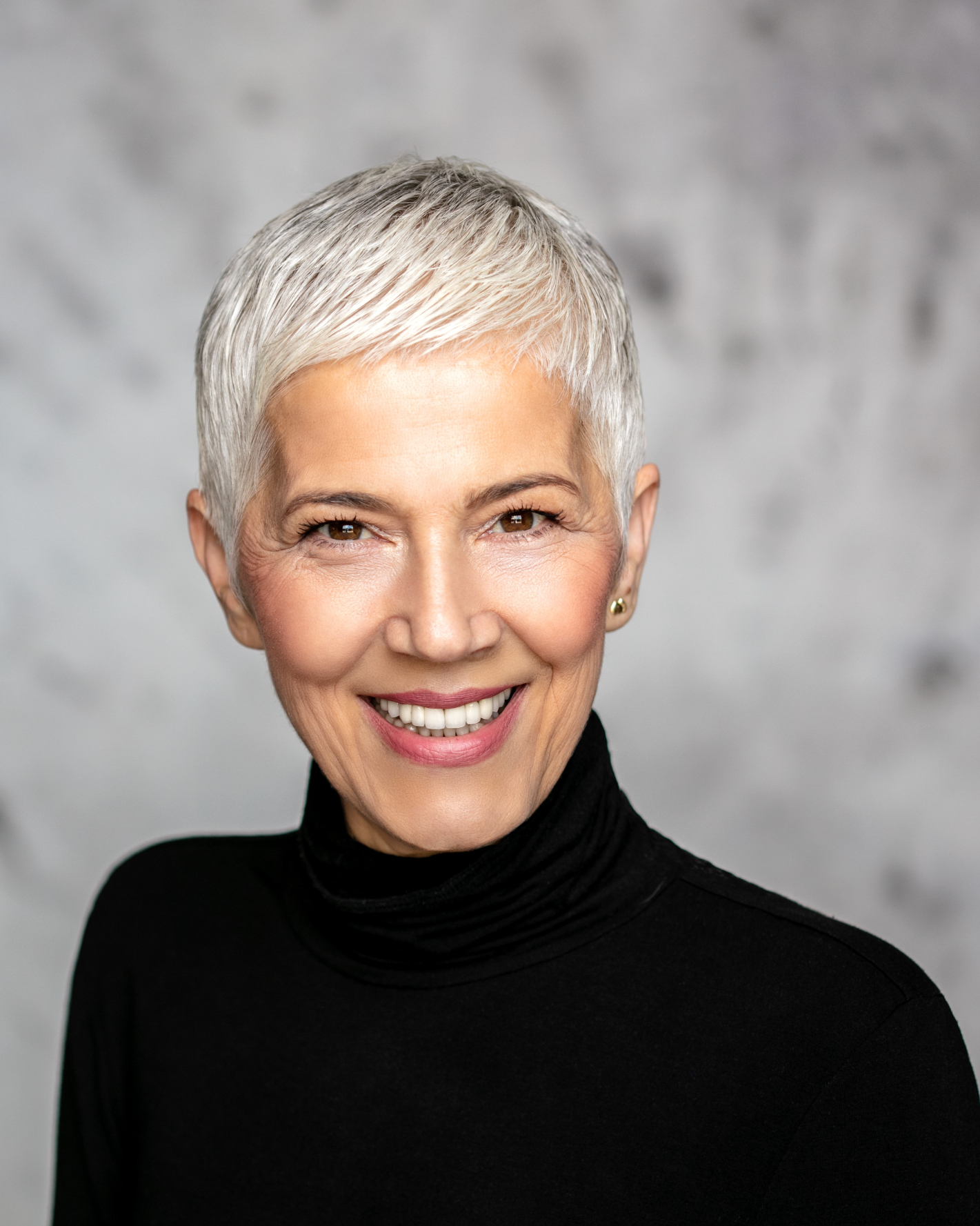 Facelift treatment at EF Medispa London