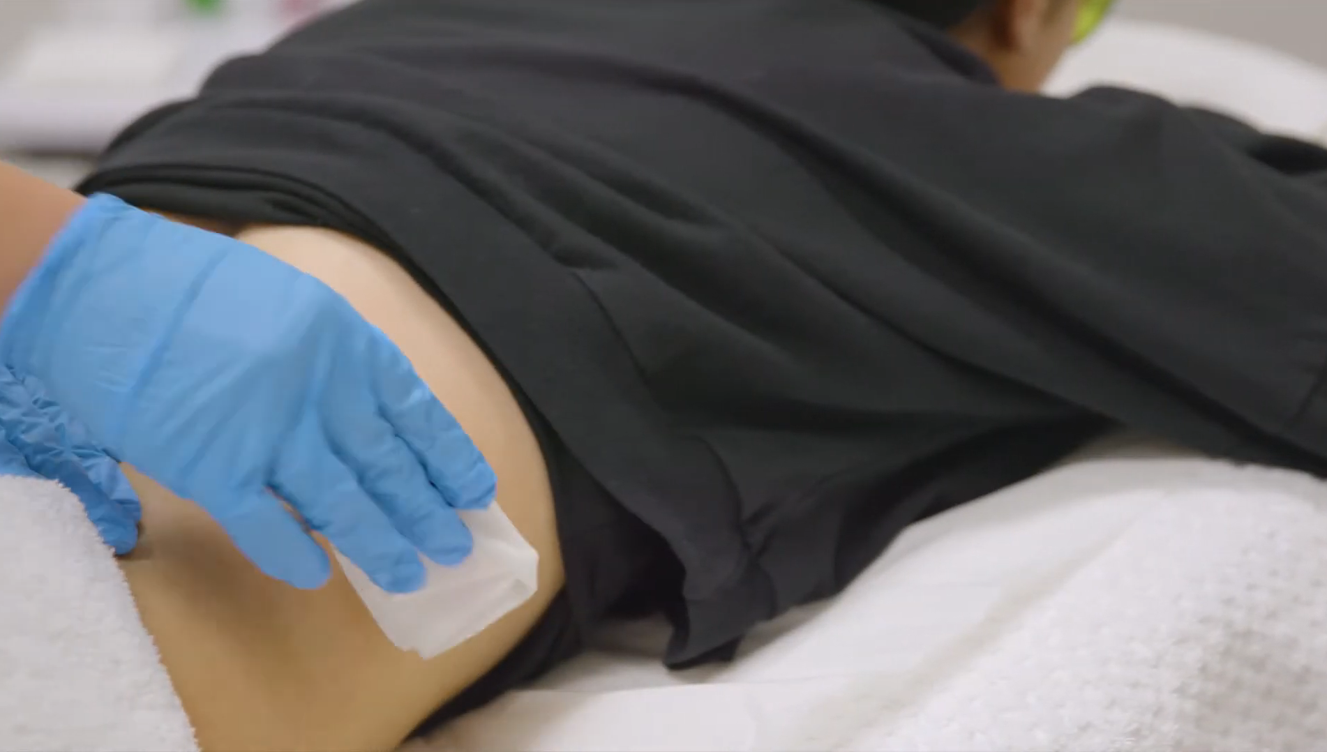 Lasert Tattoo Removal London