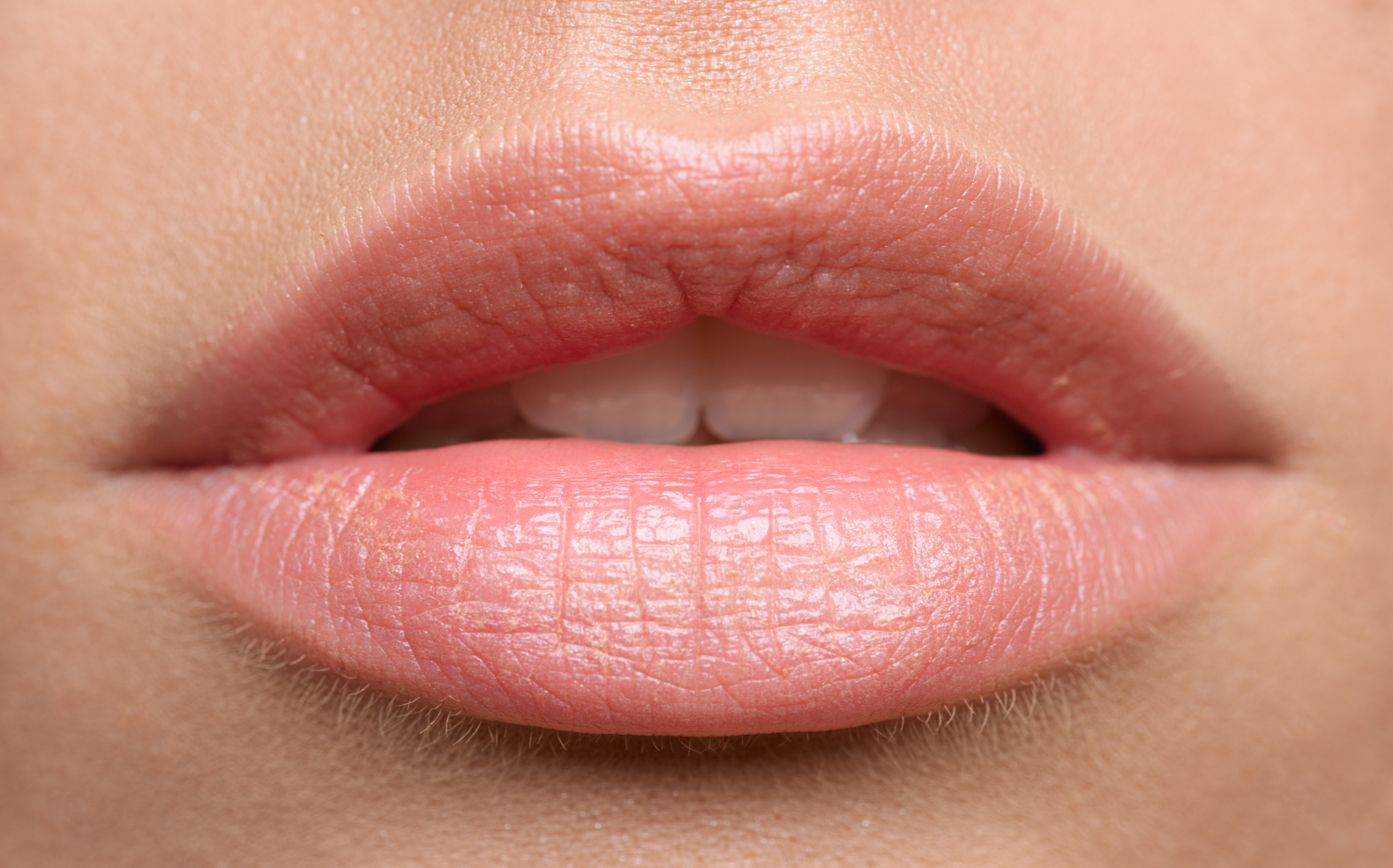 Lip fillers at EF Medispa