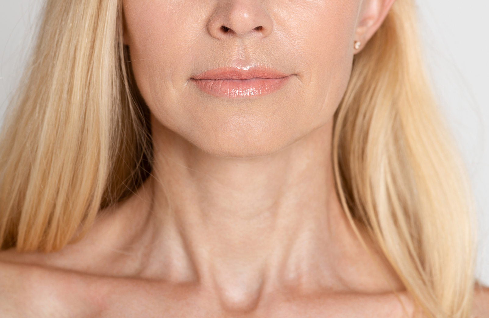Necklift treatment EF Medispa London