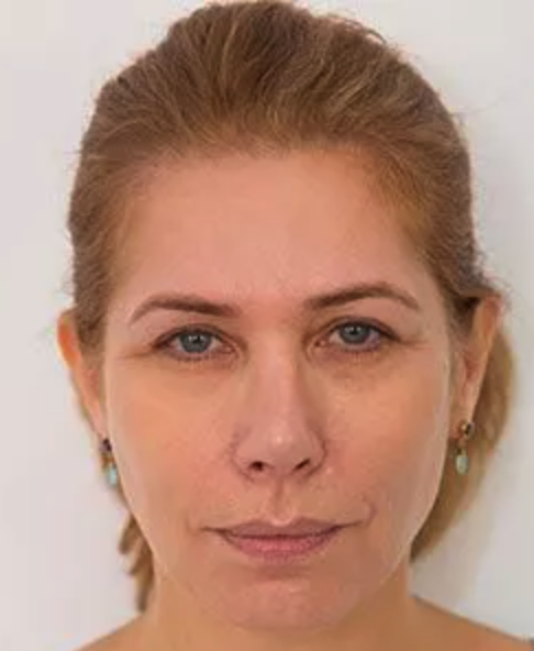 Before Temporal Lift